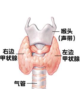 甲状腺癌的早期症状和病因